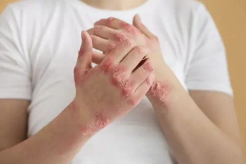 Réparation des brûlures : soulagement et guérison pour les patients