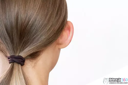 Correction des Oreilles Décollées : Avant et Après Otoplastie